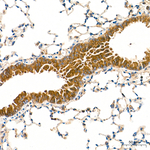 IDE Antibody in Immunohistochemistry (Paraffin) (IHC (P))