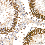 IDE Antibody in Immunohistochemistry (Paraffin) (IHC (P))