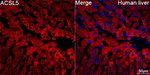 ACSL5 Antibody in Immunohistochemistry (Paraffin) (IHC (P))