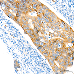 ACSL5 Antibody in Immunohistochemistry (Paraffin) (IHC (P))