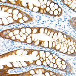 ACSL5 Antibody in Immunohistochemistry (Paraffin) (IHC (P))