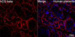 hCG beta Recombinant Rabbit Monoclonal Antibody (9P2T9)