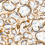 hCG beta Antibody in Immunohistochemistry (Paraffin) (IHC (P))