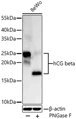 hCG beta Antibody in Western Blot (WB)