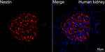 Nestin Antibody in Immunohistochemistry (Paraffin) (IHC (P))