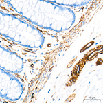 Nestin Antibody in Immunohistochemistry (Paraffin) (IHC (P))