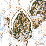 Nestin Antibody in Immunohistochemistry (Paraffin) (IHC (P))
