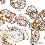 Clathrin Heavy Chain Antibody in Immunohistochemistry (Paraffin) (IHC (P))
