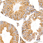 Clathrin Heavy Chain Antibody in Immunohistochemistry (Paraffin) (IHC (P))
