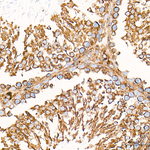 Clathrin Heavy Chain Antibody in Immunohistochemistry (Paraffin) (IHC (P))