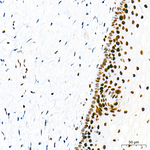 Rb Antibody in Immunohistochemistry (Paraffin) (IHC (P))