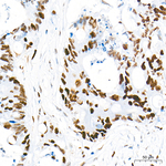 Rb Recombinant Rabbit Monoclonal Antibody (7R9H7)