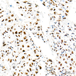 Rb Antibody in Immunohistochemistry (Paraffin) (IHC (P))