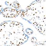 Rb Antibody in Immunohistochemistry (Paraffin) (IHC (P))