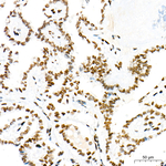 Rb Antibody in Immunohistochemistry (Paraffin) (IHC (P))