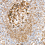 Rb Antibody in Immunohistochemistry (Paraffin) (IHC (P))