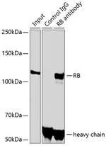 Rb Antibody in Immunoprecipitation (IP)