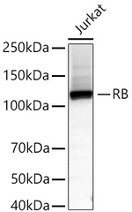 Rb Antibody in Western Blot (WB)