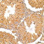 AMPK alpha-1 Antibody in Immunohistochemistry (Paraffin) (IHC (P))