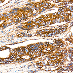 Flotillin 1 Recombinant Rabbit Monoclonal Antibody (9T2K7)