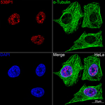 53BP1 Antibody in Immunocytochemistry (ICC/IF)