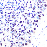 53BP1 Antibody in Immunohistochemistry (Paraffin) (IHC (P))