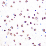 53BP1 Antibody in Immunohistochemistry (Paraffin) (IHC (P))