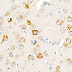 Phospho-S6 (Ser235, Ser236) Antibody in Immunohistochemistry (Paraffin) (IHC (P))