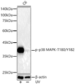 Phospho-p38 MAPK (Thr180, Tyr182) Antibody in Western Blot (WB)