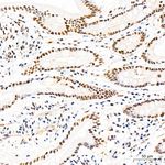 Phospho-Rb (Ser795) Antibody in Immunohistochemistry (Paraffin) (IHC (P))