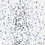 Phospho-Rb (Ser795) Antibody in Immunohistochemistry (Paraffin) (IHC (P))