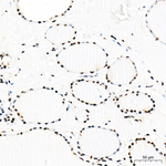 Phospho-Rb (Ser795) Recombinant Rabbit Monoclonal Antibody (9G5K3)