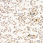 Phospho-Rb (Ser795) Antibody in Immunohistochemistry (Paraffin) (IHC (P))