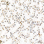 Phospho-Rb (Ser795) Antibody in Immunohistochemistry (Paraffin) (IHC (P))