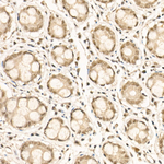 Phospho-NFkB p100 (Ser866, Ser870) Recombinant Rabbit Monoclonal Antibody (6W9S2)