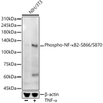 Phospho-NFkB p100 (Ser866, Ser870) Antibody in Western Blot (WB)