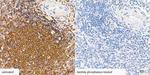 Phospho-PKC Pan (Ser660) Antibody in Immunohistochemistry (Paraffin) (IHC (P))