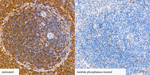 Phospho-PKC Pan (Ser660) Antibody in Immunohistochemistry (Paraffin) (IHC (P))