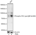 Phospho-PKC Pan (Ser660) Antibody in Western Blot (WB)