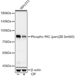 Phospho-PKC Pan (Ser660) Antibody in Western Blot (WB)