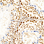 Phospho-CREB (Ser133) Antibody in Immunohistochemistry (Paraffin) (IHC (P))