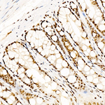 Phospho-CREB (Ser133) Antibody in Immunohistochemistry (Paraffin) (IHC (P))