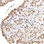 Phospho-MEK3/MEK6 (Ser189, Ser207) Antibody in Immunohistochemistry (Paraffin) (IHC (P))