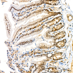 Phospho-MEK3/MEK6 (Ser189, Ser207) Antibody in Immunohistochemistry (Paraffin) (IHC (P))