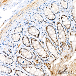 Phospho-MEK3/MEK6 (Ser189, Ser207) Antibody in Immunohistochemistry (Paraffin) (IHC (P))
