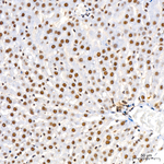 Phospho-MEK3/MEK6 (Ser189, Ser207) Antibody in Immunohistochemistry (Paraffin) (IHC (P))