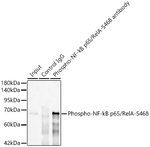 Phospho-NFkB p65 (Ser468) Antibody in Immunoprecipitation (IP)