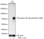 Phospho-NFkB p65 (Ser468) Antibody in Western Blot (WB)
