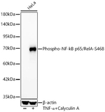 Phospho-NFkB p65 (Ser468) Antibody in Western Blot (WB)