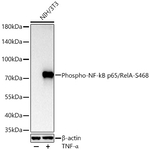 Phospho-NFkB p65 (Ser468) Recombinant Rabbit Monoclonal Antibody (4Q3L5)